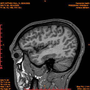 2025-06-14/SAG T1 3D/0039-IM224.png
