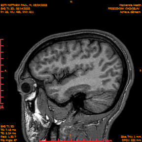 2025-06-14/SAG T1 3D/0040-IM225.png