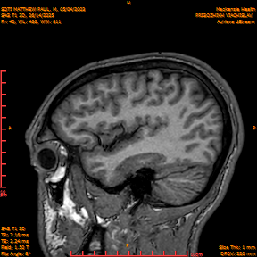 2025-06-14/SAG T1 3D/0041-IM226.png