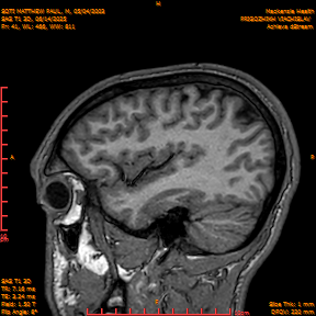 2025-06-14/SAG T1 3D/0042-IM227.png