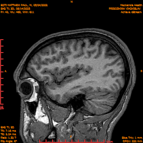 2025-06-14/SAG T1 3D/0043-IM228.png