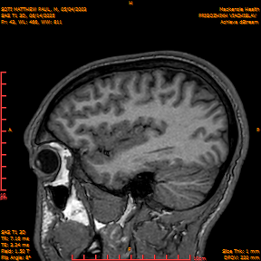 2025-06-14/SAG T1 3D/0044-IM229.png