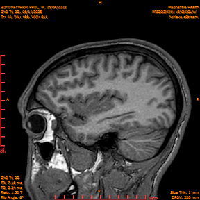2025-06-14/SAG T1 3D/0045-IM230.png
