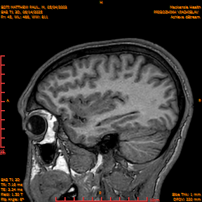 2025-06-14/SAG T1 3D/0046-IM231.png