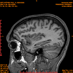 2025-06-14/SAG T1 3D/0047-IM232.png