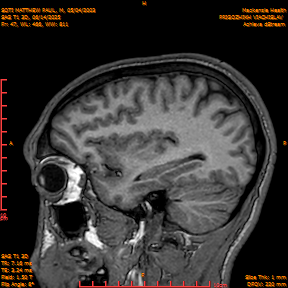 2025-06-14/SAG T1 3D/0048-IM233.png