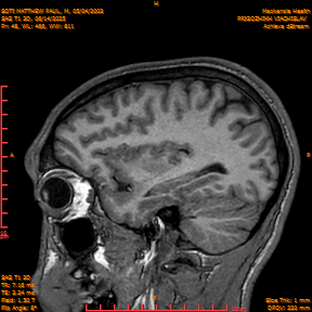 2025-06-14/SAG T1 3D/0049-IM234.png