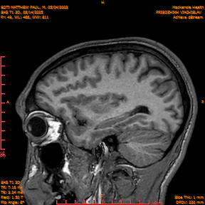 2025-06-14/SAG T1 3D/0050-IM235.png