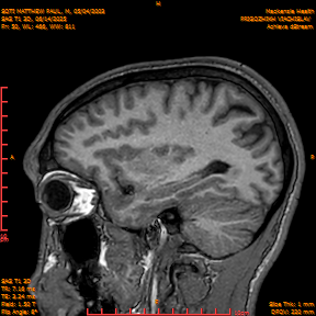 2025-06-14/SAG T1 3D/0051-IM236.png