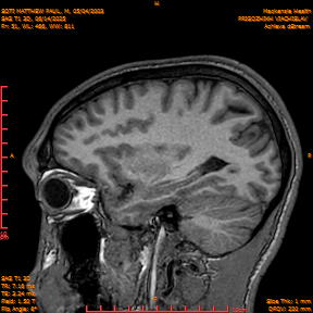 2025-06-14/SAG T1 3D/0052-IM237.png