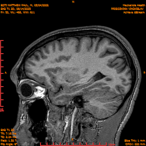 2025-06-14/SAG T1 3D/0053-IM238.png