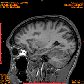 2025-06-14/SAG T1 3D/0054-IM239.png