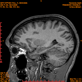 2025-06-14/SAG T1 3D/0055-IM240.png