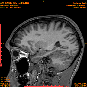 2025-06-14/SAG T1 3D/0056-IM241.png