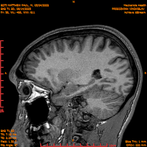 2025-06-14/SAG T1 3D/0057-IM242.png