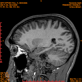 2025-06-14/SAG T1 3D/0058-IM243.png