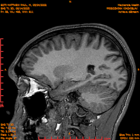 2025-06-14/SAG T1 3D/0059-IM244.png