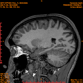 2025-06-14/SAG T1 3D/0060-IM245.png