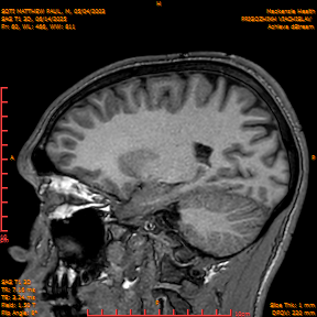 2025-06-14/SAG T1 3D/0061-IM246.png