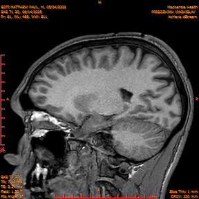 2025-06-14/SAG T1 3D/0062-IM247.png