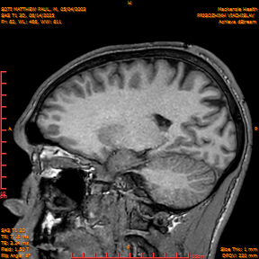 2025-06-14/SAG T1 3D/0063-IM248.png