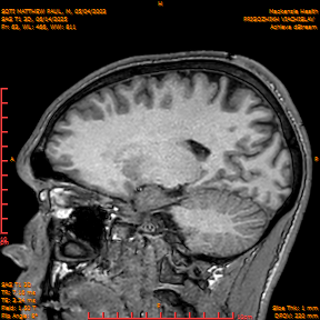 2025-06-14/SAG T1 3D/0064-IM249.png