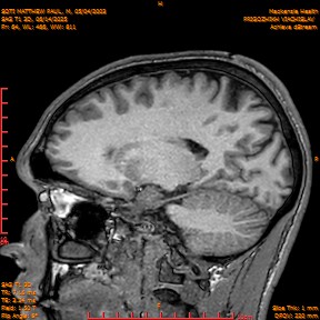 2025-06-14/SAG T1 3D/0065-IM250.png
