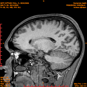 2025-06-14/SAG T1 3D/0066-IM251.png
