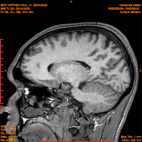 2025-06-14/SAG T1 3D/0067-IM252.png