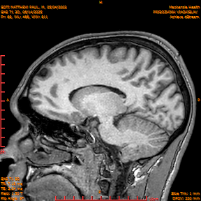 2025-06-14/SAG T1 3D/0069-IM254.png