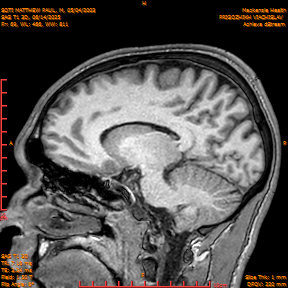 2025-06-14/SAG T1 3D/0070-IM255.png