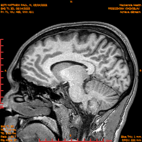 2025-06-14/SAG T1 3D/0072-IM257.png