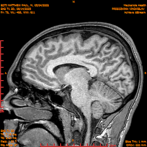 2025-06-14/SAG T1 3D/0074-IM259.png
