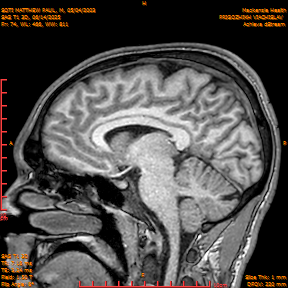 2025-06-14/SAG T1 3D/0075-IM260.png