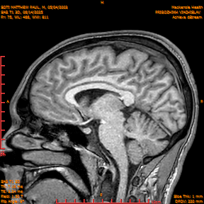 2025-06-14/SAG T1 3D/0076-IM261.png