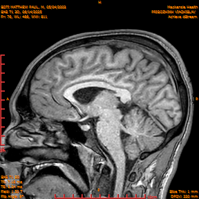 2025-06-14/SAG T1 3D/0077-IM262.png