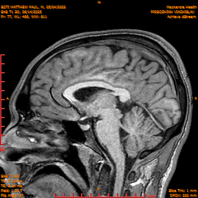 2025-06-14/SAG T1 3D/0078-IM263.png