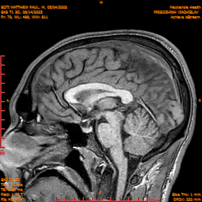 2025-06-14/SAG T1 3D/0080-IM265.png