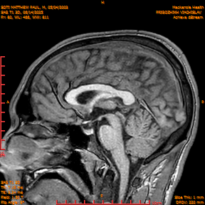 2025-06-14/SAG T1 3D/0081-IM266.png