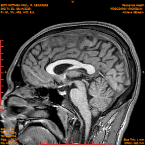 2025-06-14/SAG T1 3D/0082-IM267.png