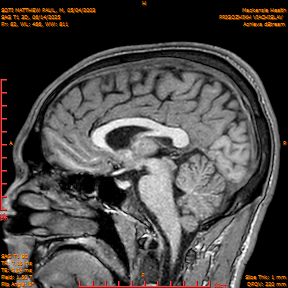 2025-06-14/SAG T1 3D/0083-IM268.png