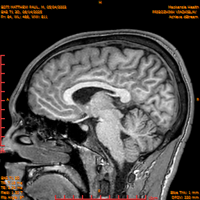 2025-06-14/SAG T1 3D/0085-IM270.png