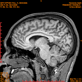 2025-06-14/SAG T1 3D/0087-IM272.png