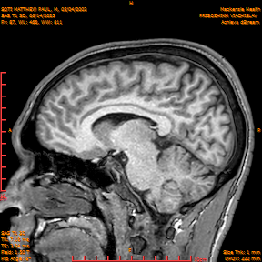 2025-06-14/SAG T1 3D/0088-IM273.png