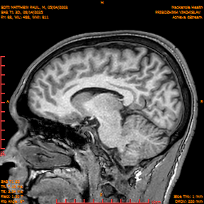 2025-06-14/SAG T1 3D/0089-IM274.png