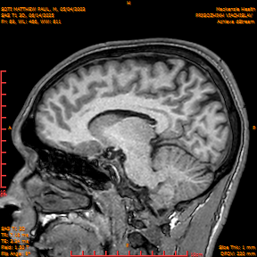 2025-06-14/SAG T1 3D/0090-IM275.png