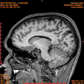 2025-06-14/SAG T1 3D/0091-IM276.png