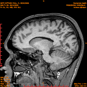 2025-06-14/SAG T1 3D/0092-IM277.png