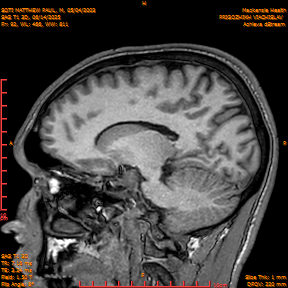 2025-06-14/SAG T1 3D/0093-IM278.png