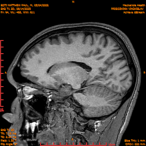 2025-06-14/SAG T1 3D/0095-IM280.png